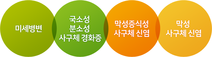 미세병변, 국소성 분소성 사구체 경화증, 막성증식성 사구체 신염, 막성 사구체 신염